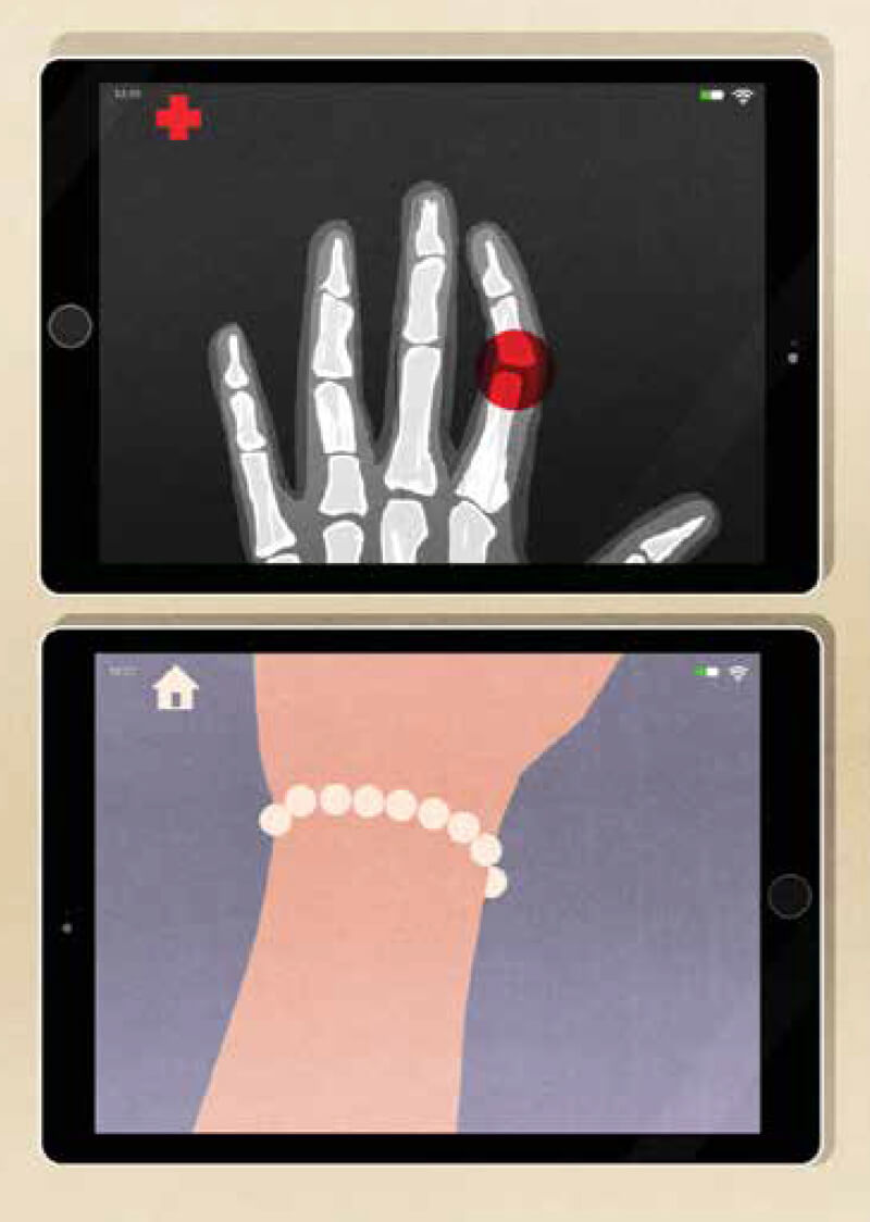 Illustration of hand x-ray